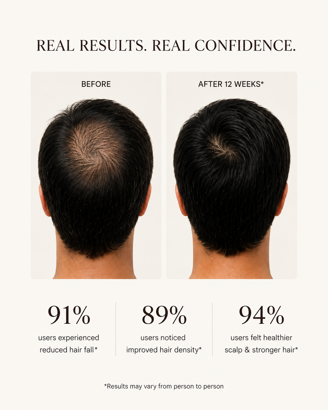 ORREN - Hair Revitalising Mist